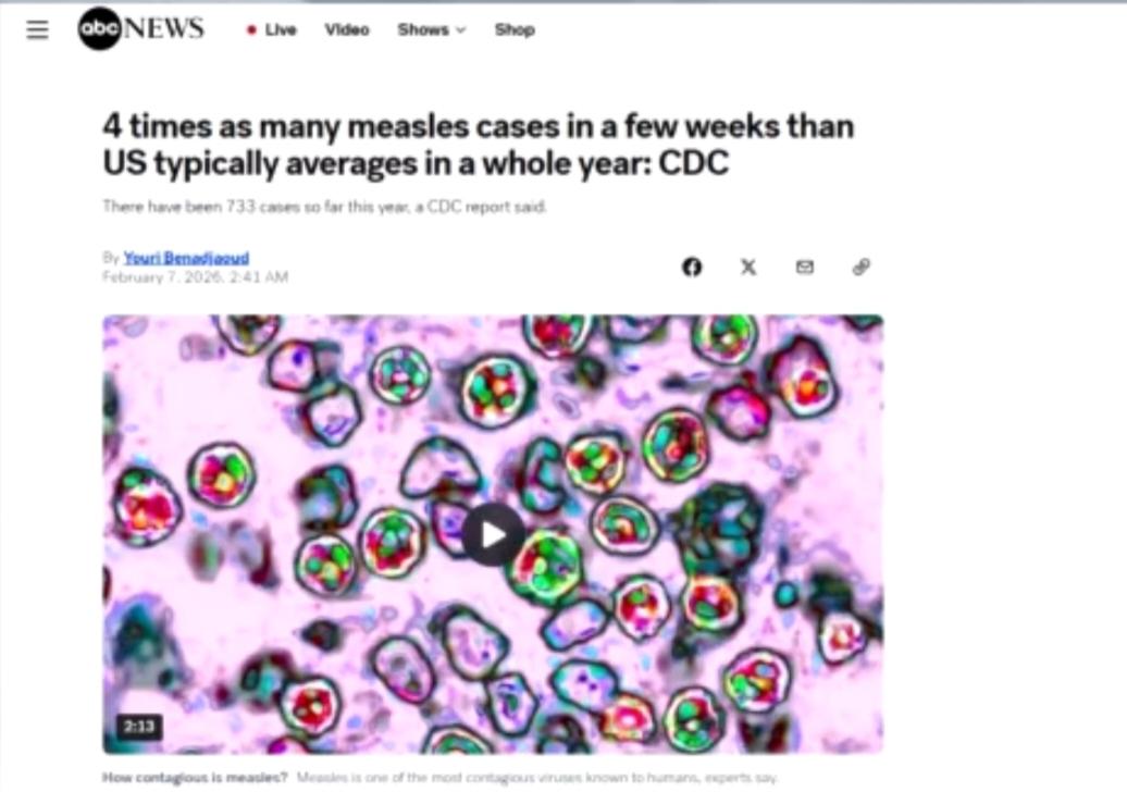 大家晚安。根据美国疾控中心最新通报，今年美国麻疹病例已达733例，短短几周就达到