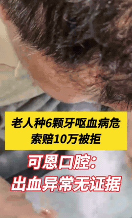 “必须严查！”山东青岛，一66岁老人花35000元，种了6颗牙，种完后呕血，出血