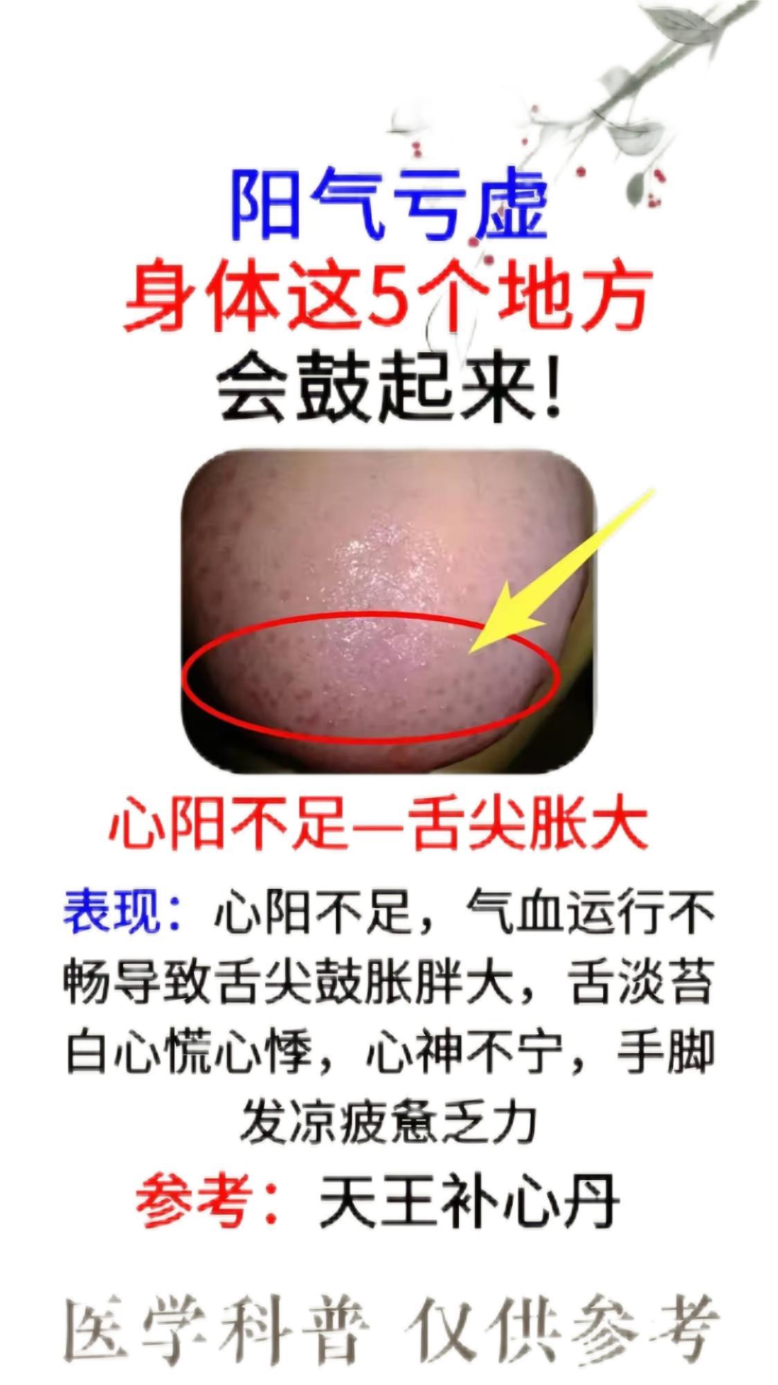阳气亏虚”身体这5个地方会鼓起来!对照一下收藏备用。