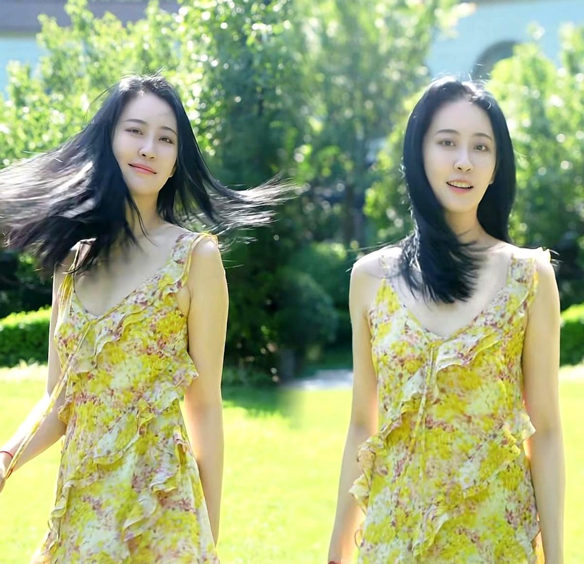 锁骨断了，戏没了，十年没缓过劲来。
《伪装者》里她演得狠，结果镜头全砍了。
后来