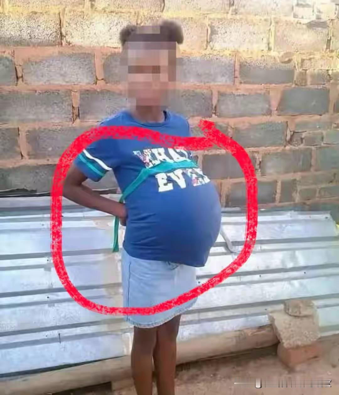 南非儿童保护危机：数据背后的社会之痛

一组数据引发关注：南非医疗机构记录显示，