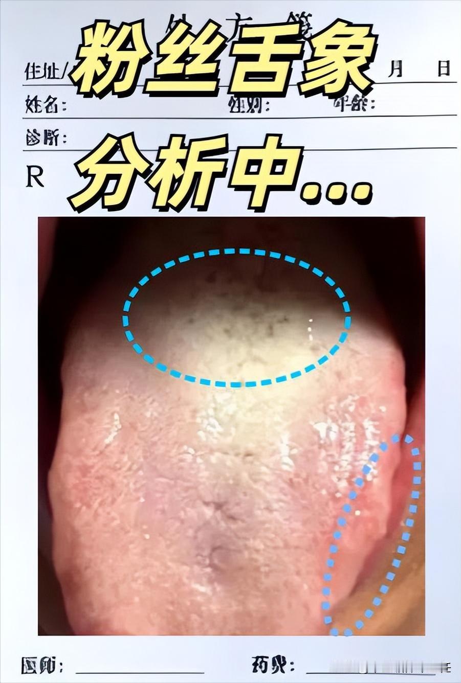 仗着年轻啥都不在乎，手搓了12年，现在好了，巨龙变成了小蚯蚓知道害怕了！

这个
