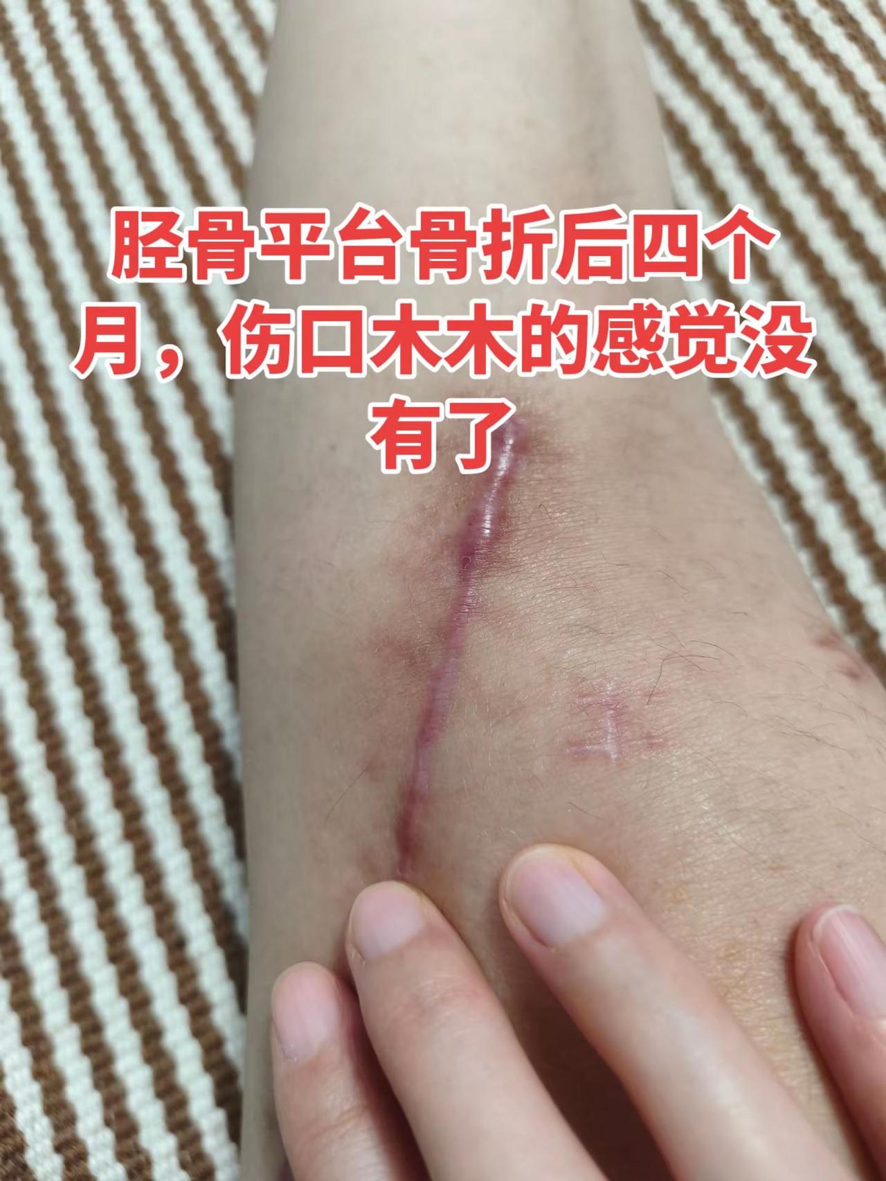 四个月了，越来越好了