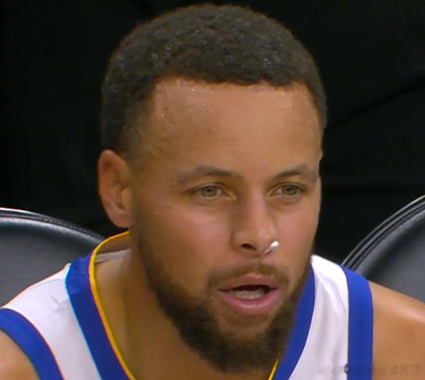 话说前天我就想问了，他这鼻子塞的什么东西？好像也不是流鼻血 