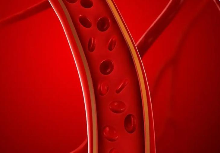 脑梗谨记，早晨1大忌，中午2不要，晚上3不做

脑梗应该都不陌生，有一个特别让神