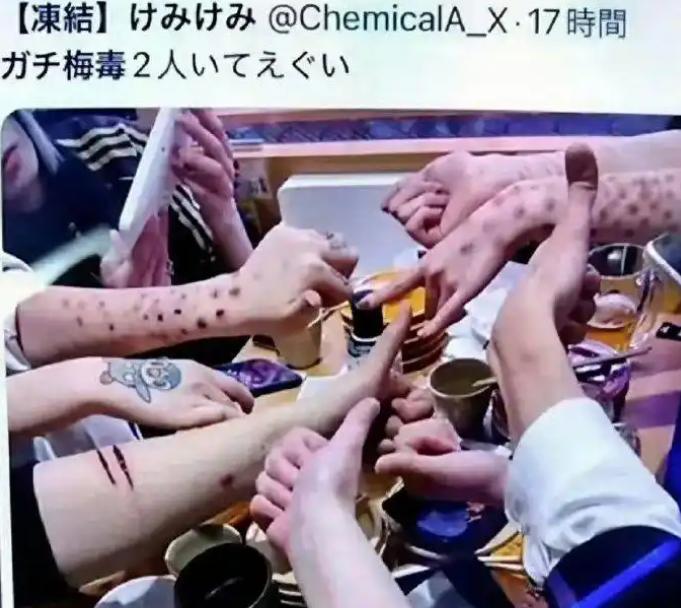没药了。
 
日本梅毒感染连续四年破万，而唯一的救命药青霉素，因为辉瑞工厂异物混