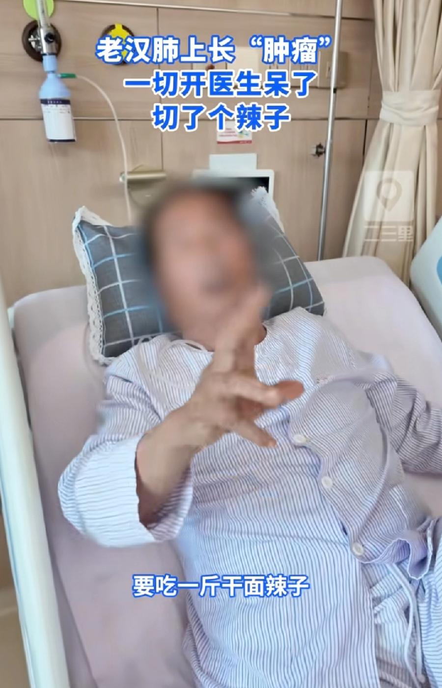 大爷肺癌手术切出来竟是辣椒！虚惊一场，不过是惊喜！原来大爷无辣不欢，每天一斤干面