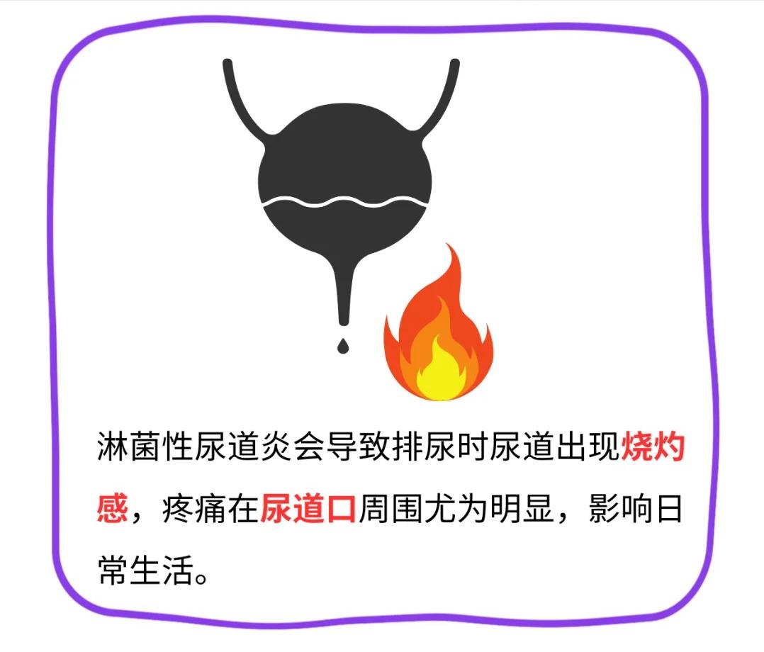 【淋菌性尿道炎的6种症状别忽视！】




淋菌性尿道炎是由淋病奈瑟菌引起的一种