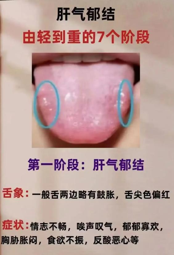 肝气郁结从轻到重，这 7 个阶段要分清