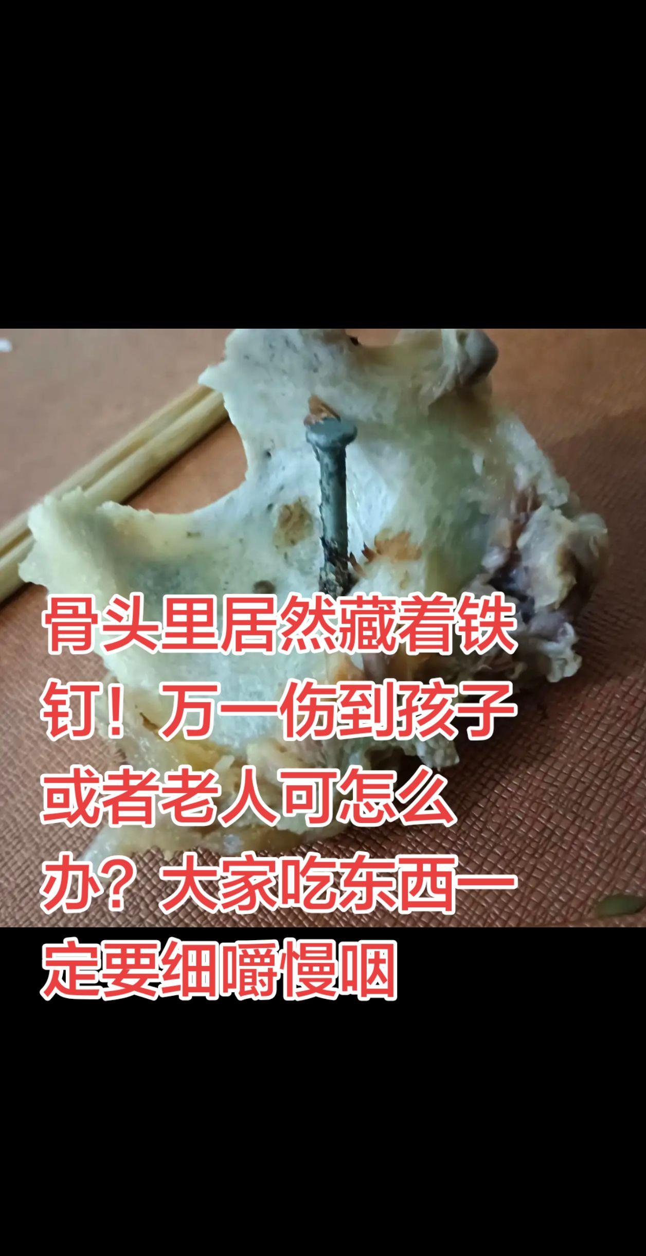 吃饭一定要小心！我今天就中招了，骨头里居然藏着铁钉！这可不是小事，万一伤到孩子或