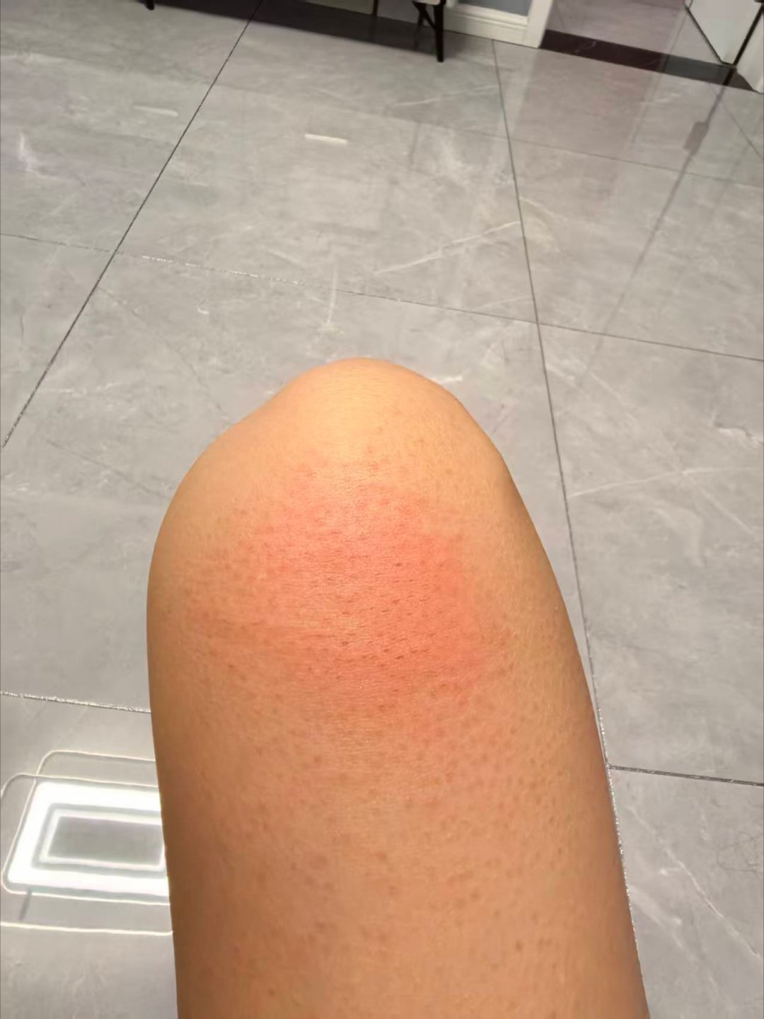 今年的第一搓，搓澡大姐好像疯了，硬生生把腿给我搓秃噜皮啦，好疼啊，要不是素质压制