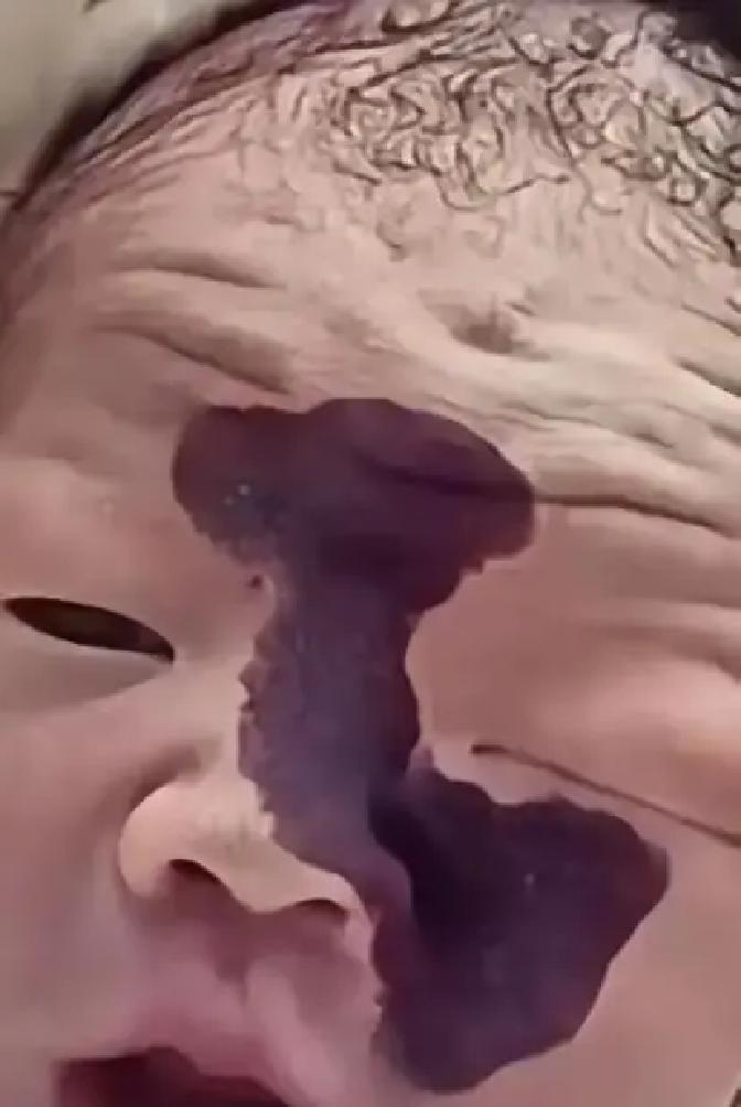 产检照片里那块淡红印子被大夫随口说成可能是胎记，老公当场脸就垮，回家路上一句“要