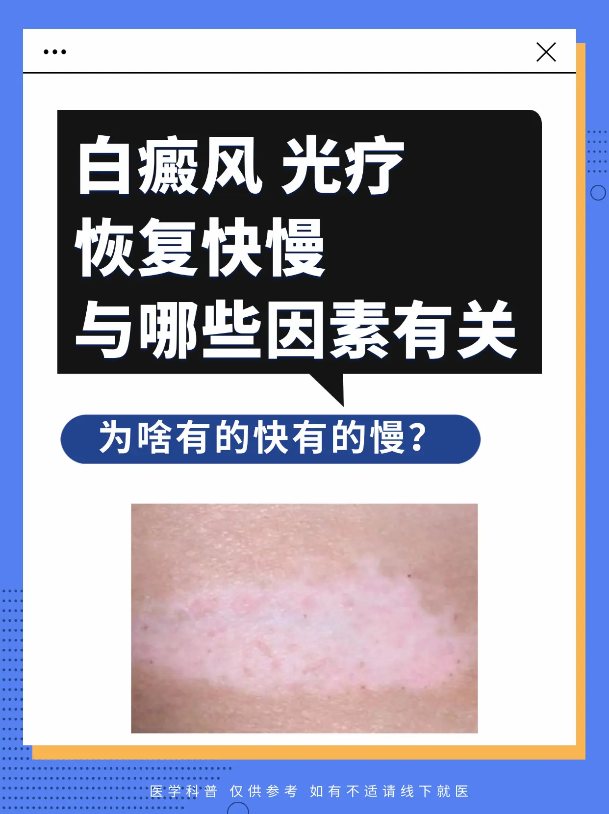 医学科普 白癜风 白斑 硬核健康科普行动 医疗健康训练营