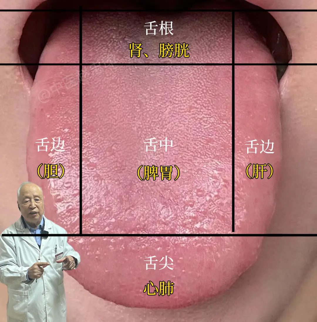 肝胆看舌边，心肺看舌尖，脾胃看舌中，肾看舌根 ①肝胆看舌舌边 1.如果...