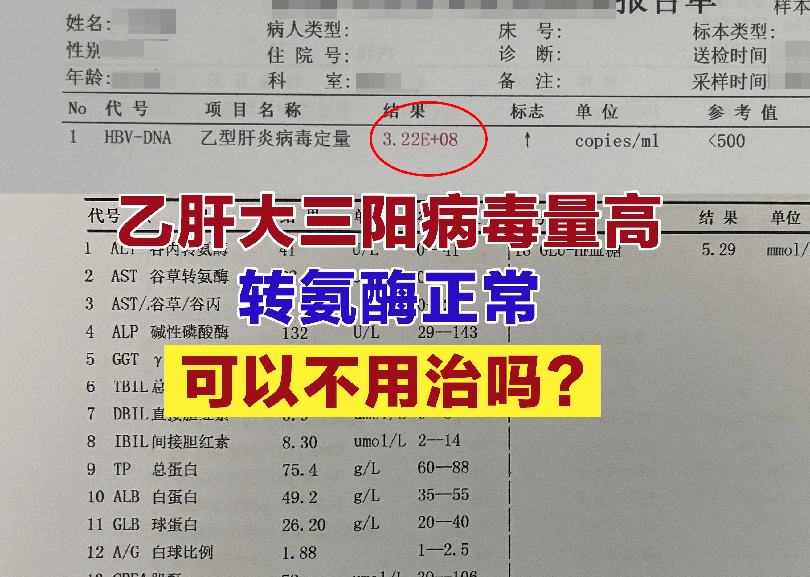 门诊经常遇到乙肝大三阳患者咨询：“医生，我查出来大三阳，HBV DNA...