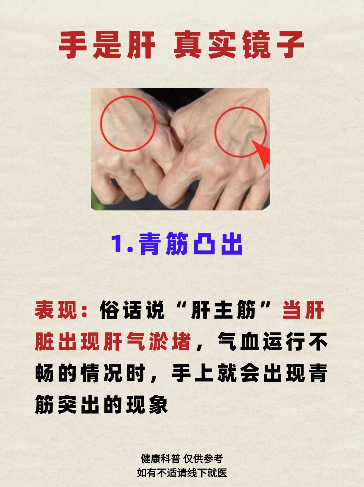 手是肝的真实镜子！肝不好的人，手上会有5个现象，你若没有，说明你肝很好！