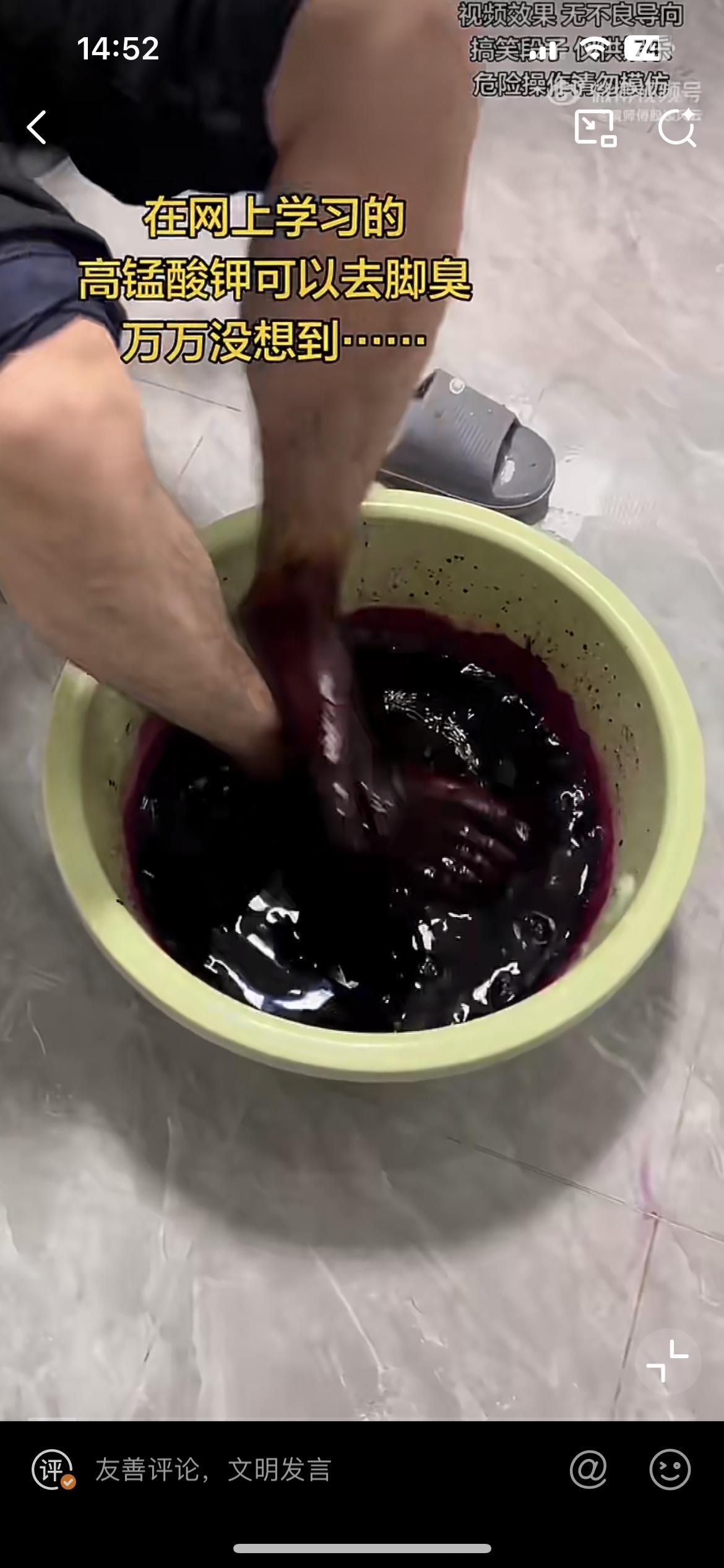 偏方害人！男子高锰酸钾泡脚治脚臭，脚被染成深紫洗不掉。
一名男子听信民间偏方，想