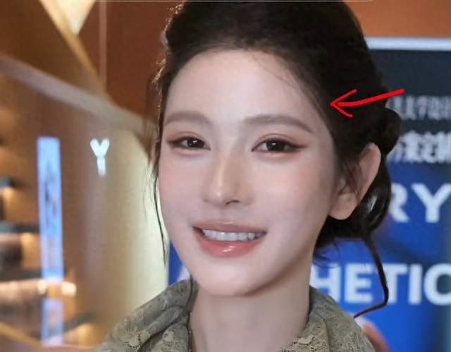 网红黄婉均整容后回老家，熟人都认不出，丈夫梅尼耶看旧照被吓跑