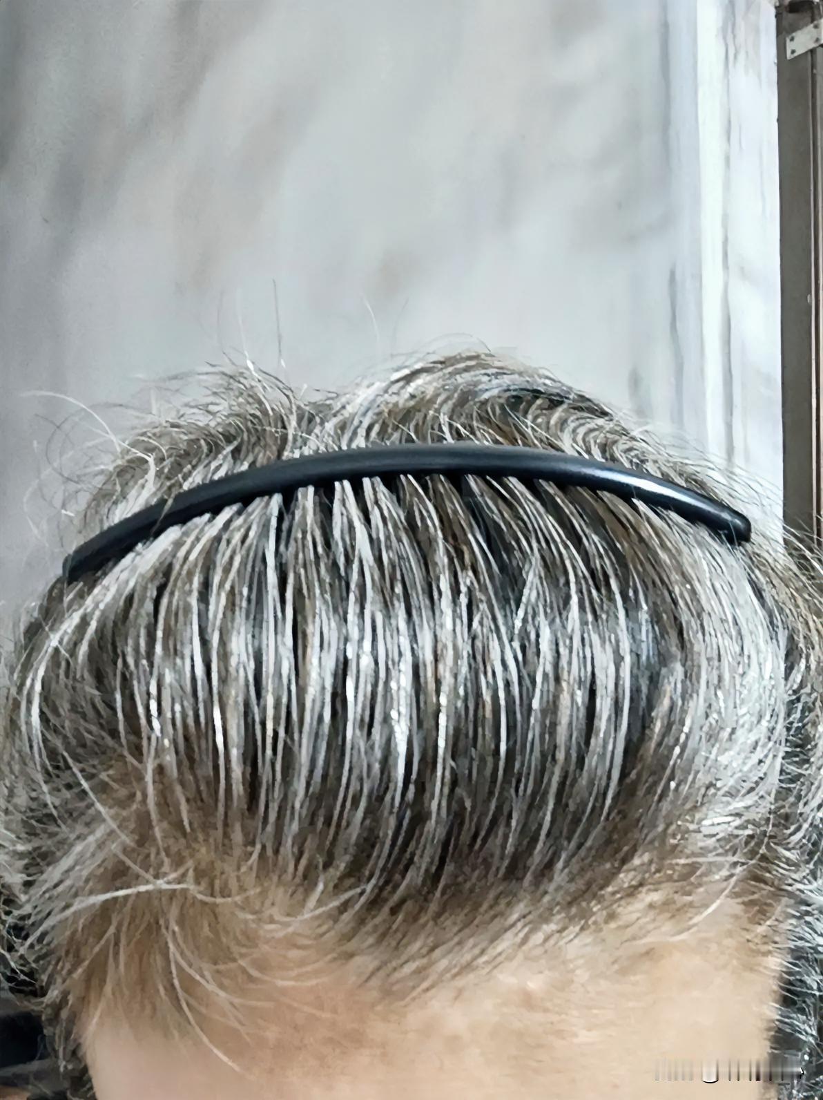 终于接受了白头发。
我是30多岁开始有白头发。刚开始时，发现一根就拔一根。

结