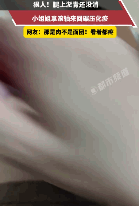 这操作简直惊掉下巴！海南一位女子面对腿上顽固的淤青，竟做出了一个让所有健身教练和