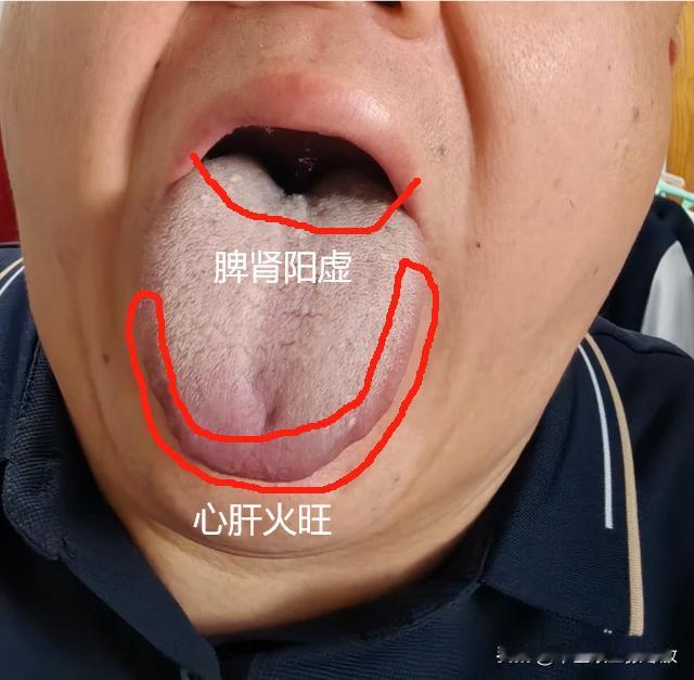 40来岁大哥，上有老下有小的，琐事太多，担子太重了[给力][给力][给力]
看肝