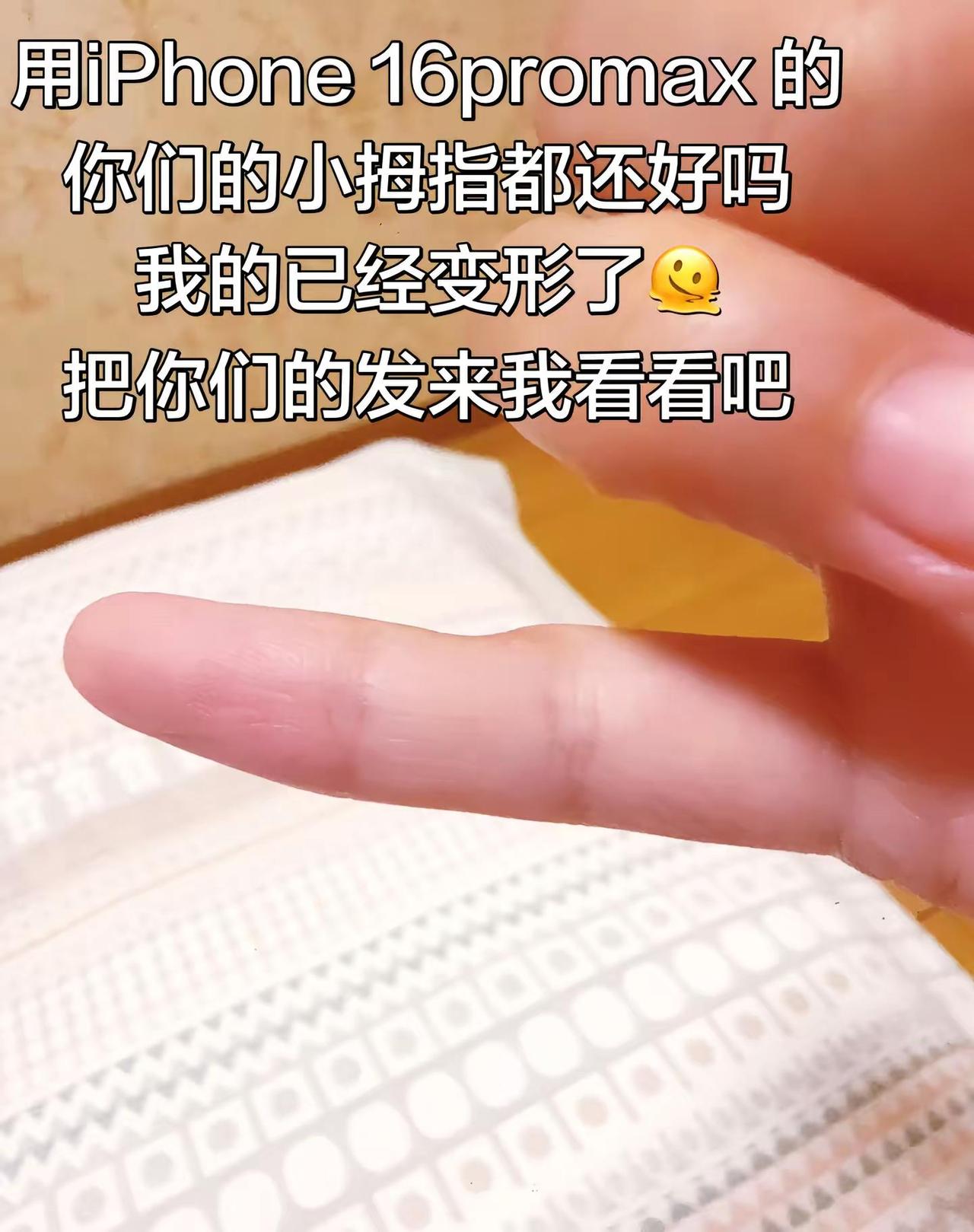 iphone iphone16promax 手指变形