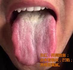 房市有心无力，次次以秒计算，难起易谢，只因他吃了桂附地黄芄和西地那非！
 
这个
