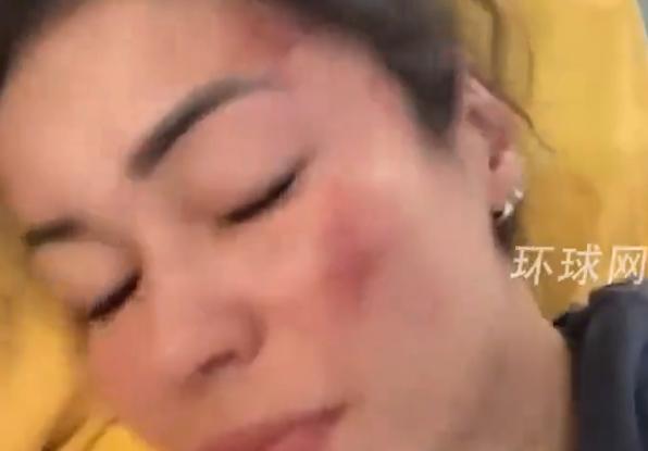 一对西班牙夫妻在印度被7人轮流侵害长达3个小时！

2024年3月1日，两人抵达