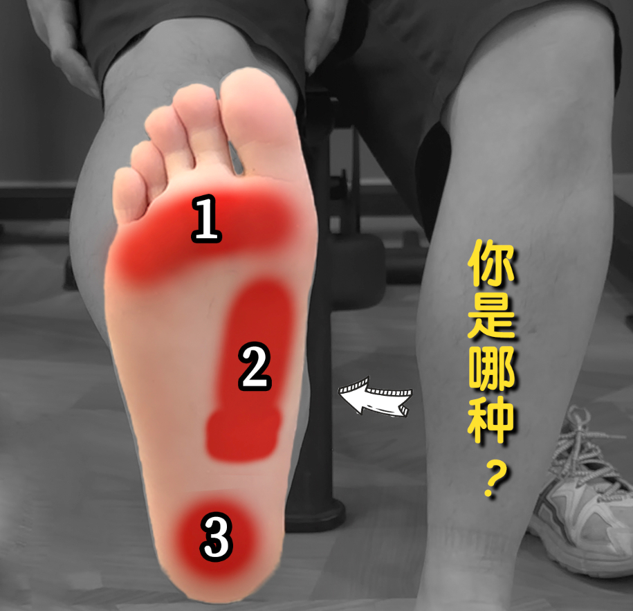 【科普视频预告】今天中午，来给大家解析“足底筋膜炎”先来看这张图，你的足底疼，更