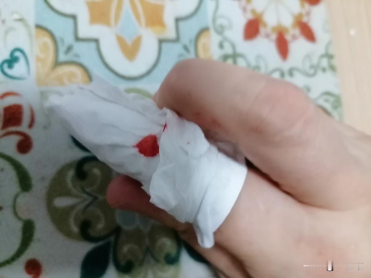 佩服自己的“能干”，我自己把自己给切了！

打开固定胶时因为动作不规范，刀片同时
