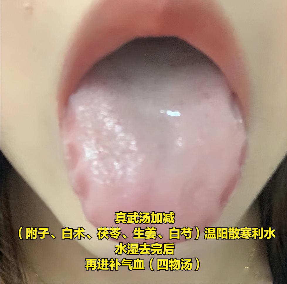 附子可不是补阳的，用不好反而会亡阳！
 
很多人认为附子能补阳，所以不少人只要碰