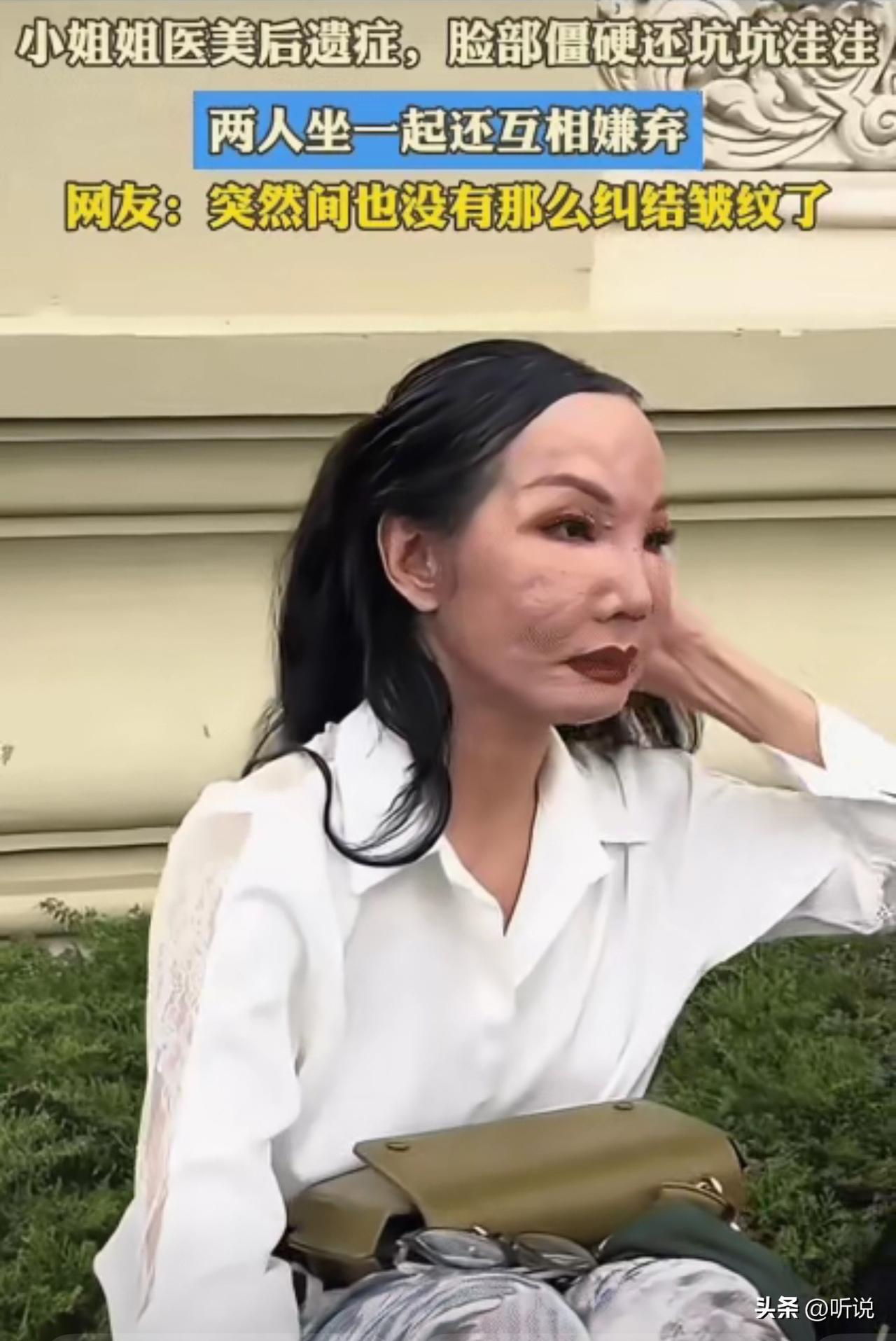 考验爱情的不止是疾病，还有容貌，整成这样，老公真的能不离不弃吗？