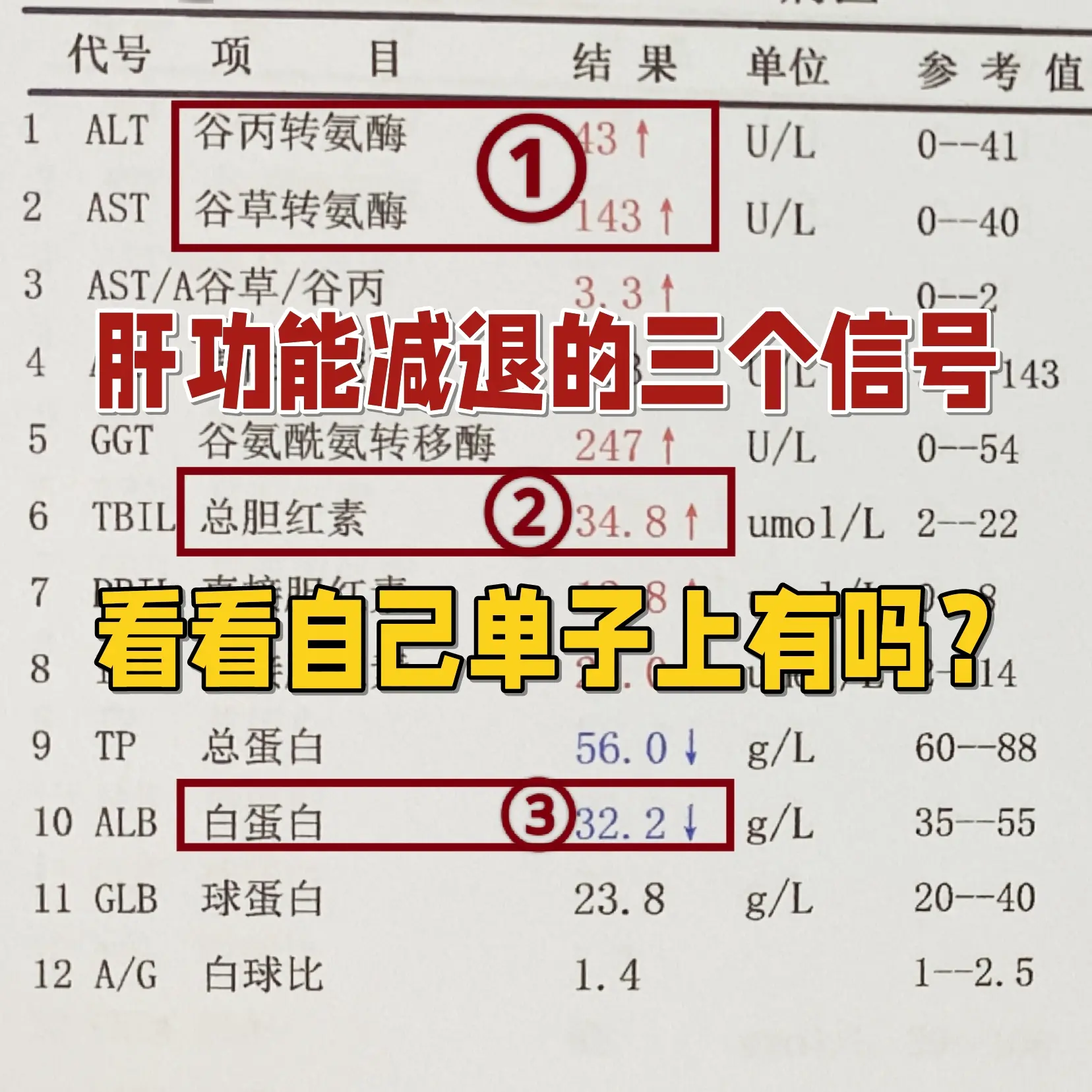 肝功能检查是我们判断肝脏健康状况的一项非常基础的检查，其中有三项指标比...