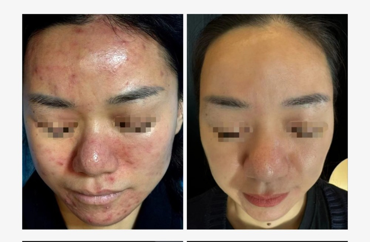 薅一下美迪迈团的流程西安 北京 上海 杭州 厦门 天津 苏州 哈尔滨 深圳大家在