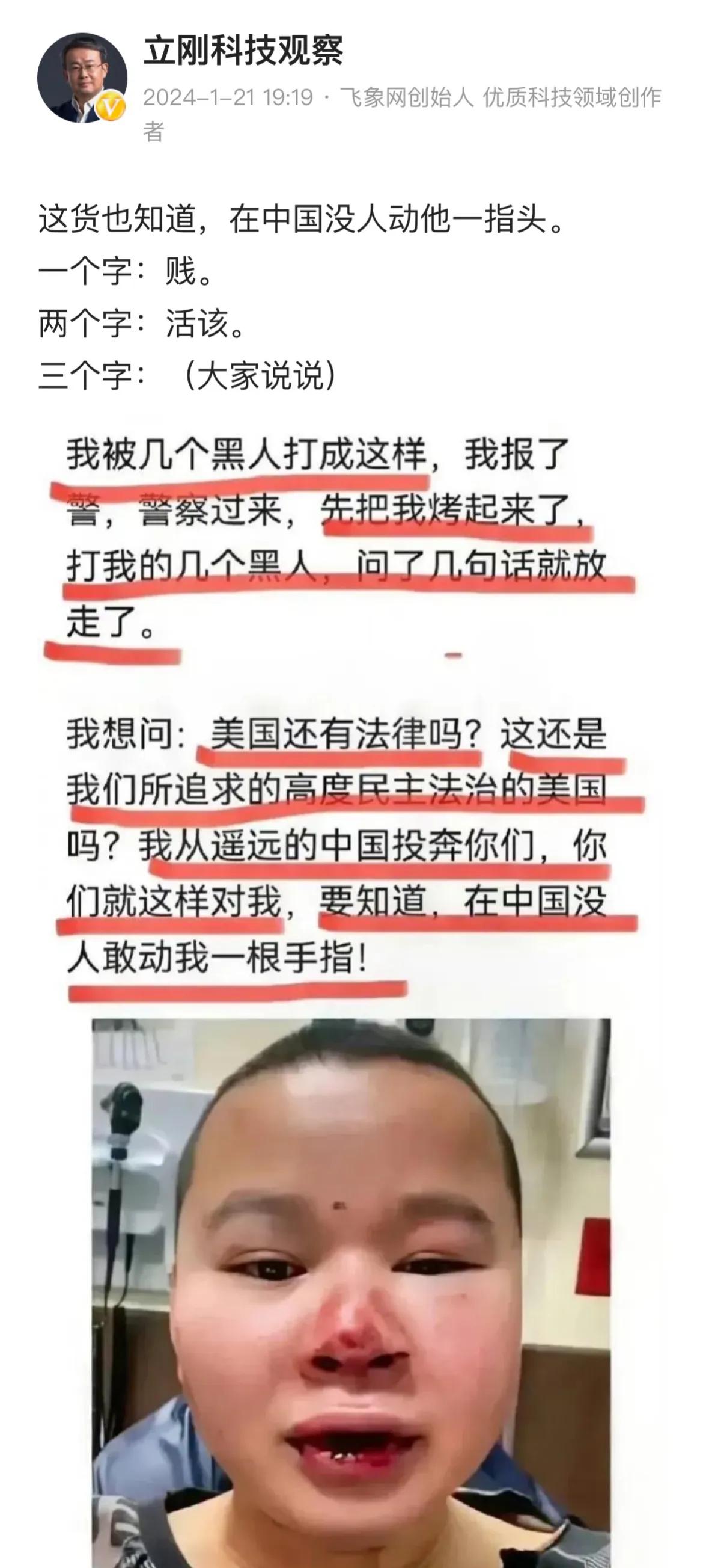 著名通信专家项立刚怒斥一个润人在美国被老黑打！
有人说被黑人打了，到没人管，还把
