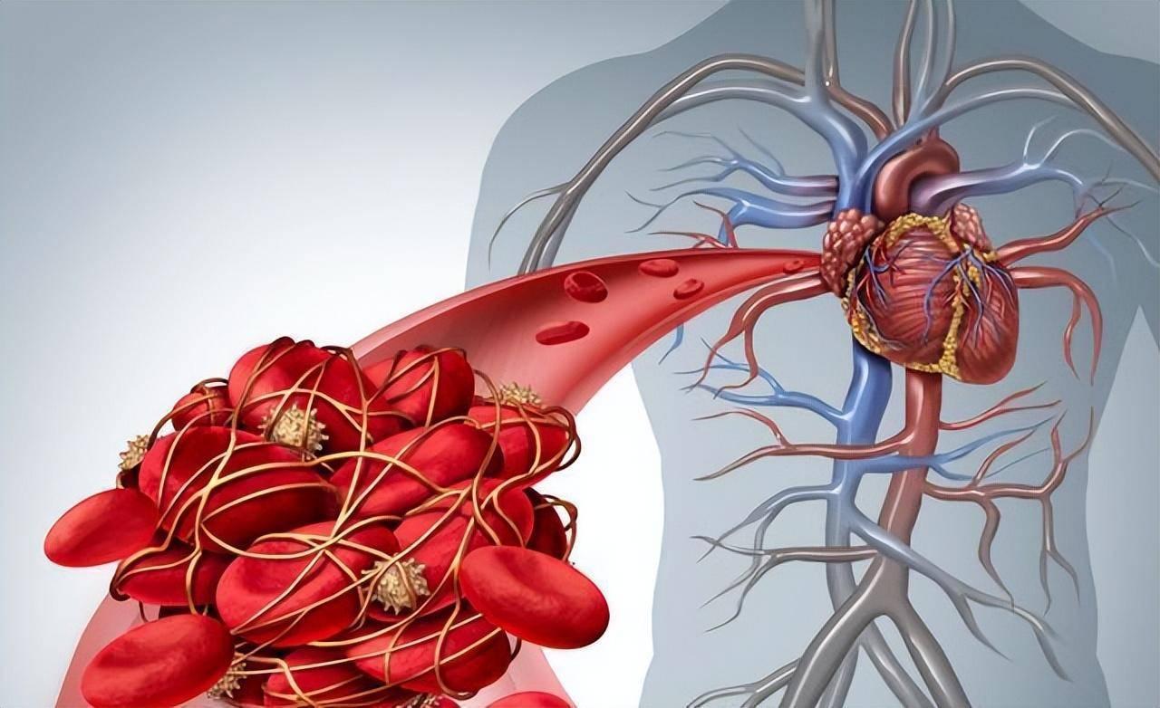 一、开头：天冷心脑血管易 “受伤”！这 4 个原则能帮你避开风险
 
一到冬天，