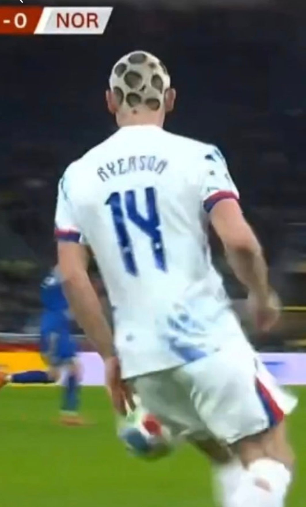 脚球男们不要学这个发型