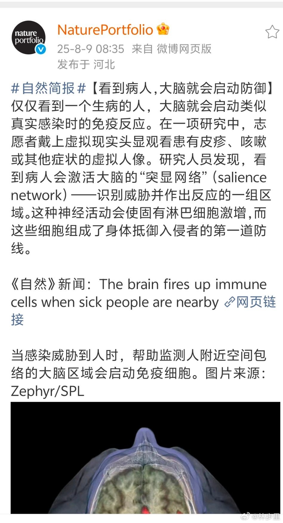 身体的免疫细胞，时刻戒备抵御病原体的入侵。只有某些宿主的脑袋，可能与免疫细胞背道