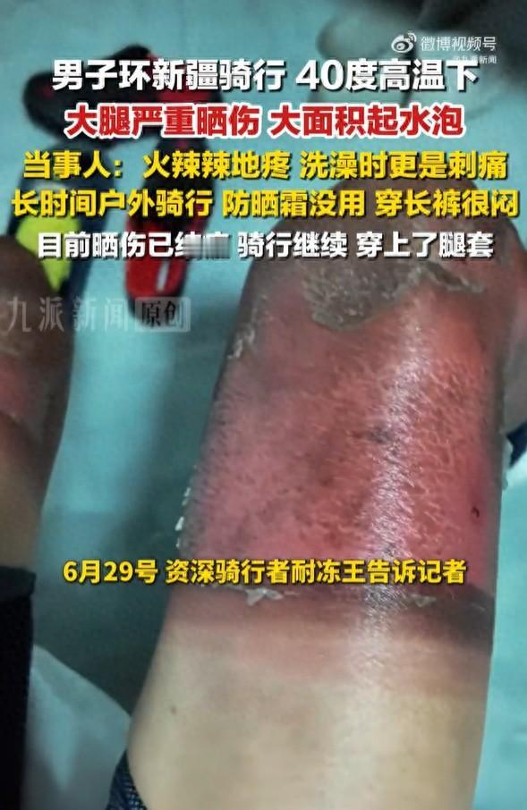 新疆，一男子环疆骑行，嫌长裤闷热，索性穿短裤上路。怎料每日骑行超10小时，又撞上