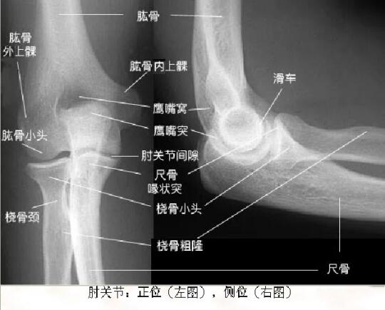 X线平片