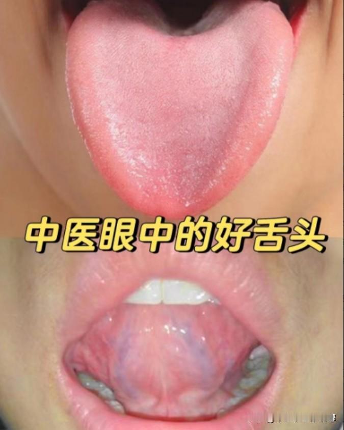 挑战一天看66个舌象，十分钟出结果！！！

注意事项
1、距离十公分左右
2、无