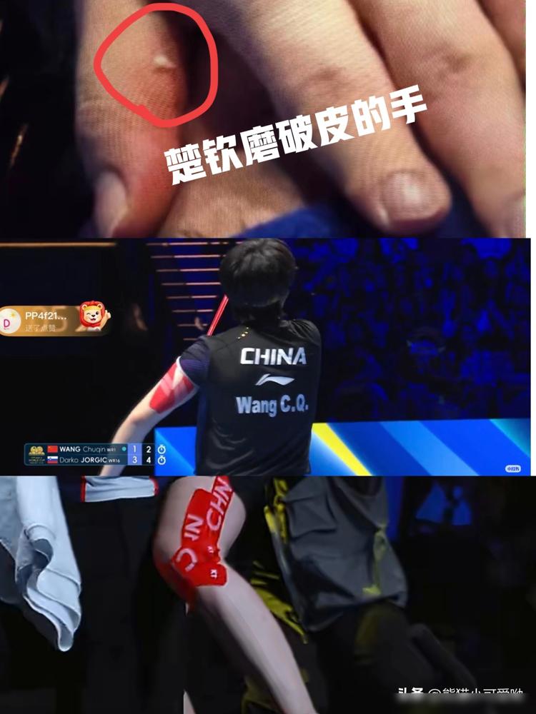 别盯着王楚钦和孙颖莎满身的肌肉贴自我感动了。那不是勋章，是顶级精密仪器在极限负荷