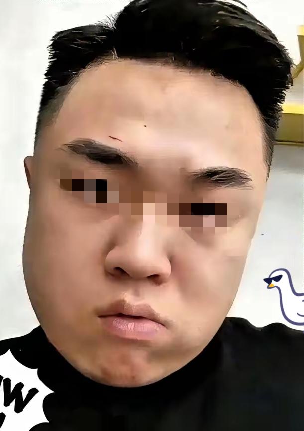 天狂必有雨，人狂必有祸，
​女孩母亲态度坚决：
​不签谅解书、不和解、不接受赔偿