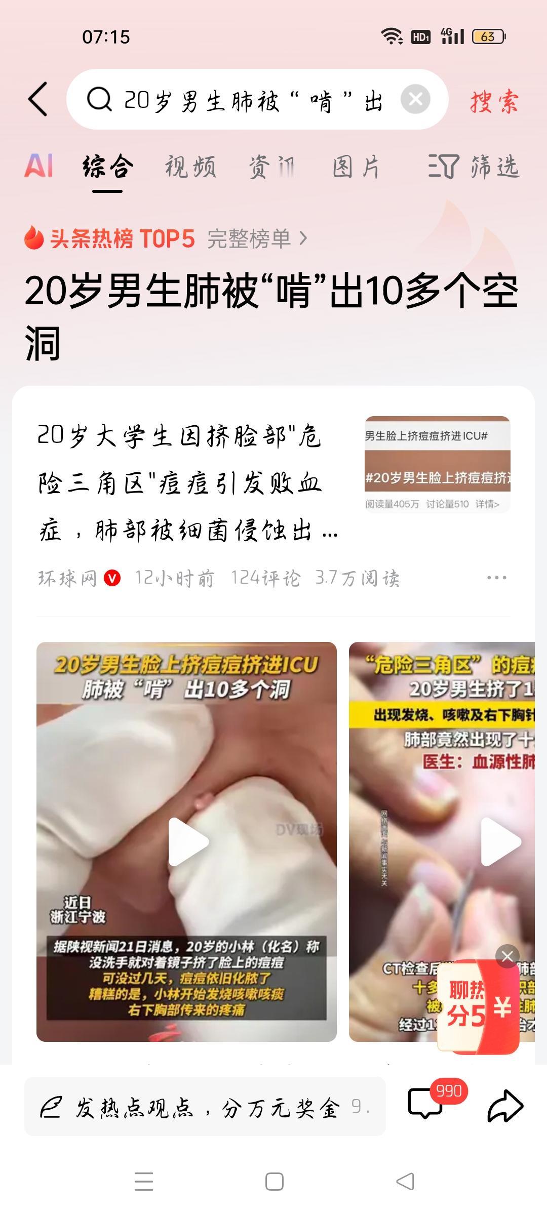 20岁男生肺被“啃出＂10多个空洞，我想说
据环球网报道，大二男生因挤痘痘引发败