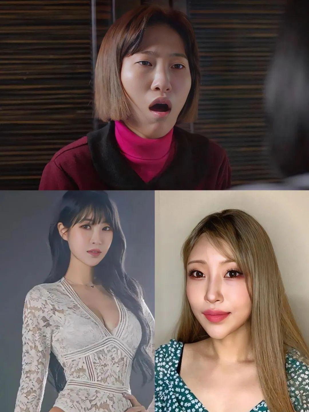 演员李世英近日自曝花费约1亿5千万韩元（约79万人民币）做整形手术，做了全脸和胸