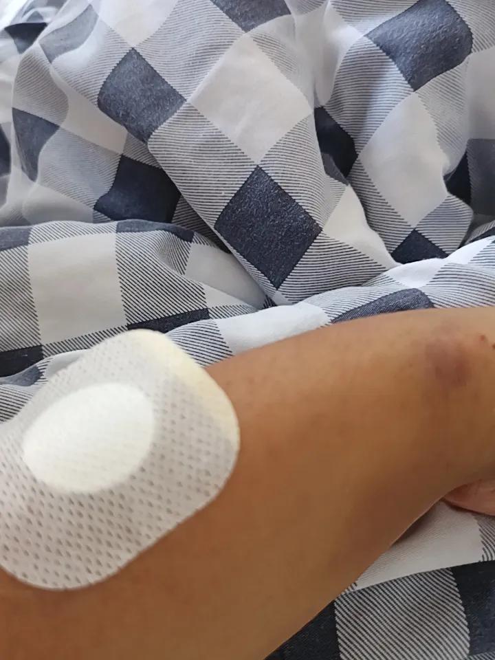 你敢相信吗？我看的是西医，他竟然是中西结合帮我治疗。贴的竟然是艾草。