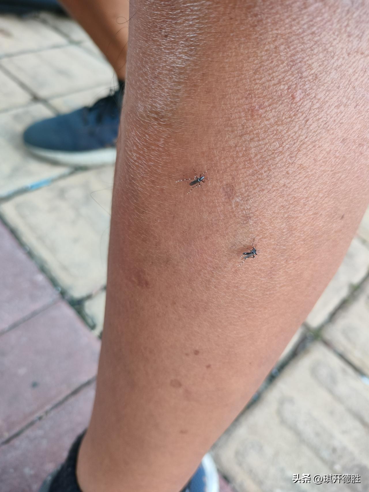 现在的黑花蚊子毒性越来越大，我以前是不怕蚊子咬的，蚊子咬一口，起个小红点一会儿就