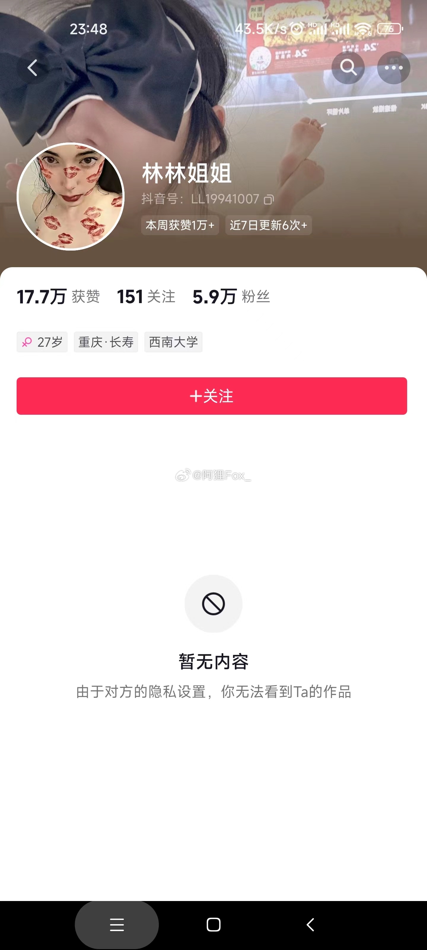 不是本人，盗图者si全家。事先特意把我都拉黑了～自己长得很丑嘛？非得拿别人脸不露