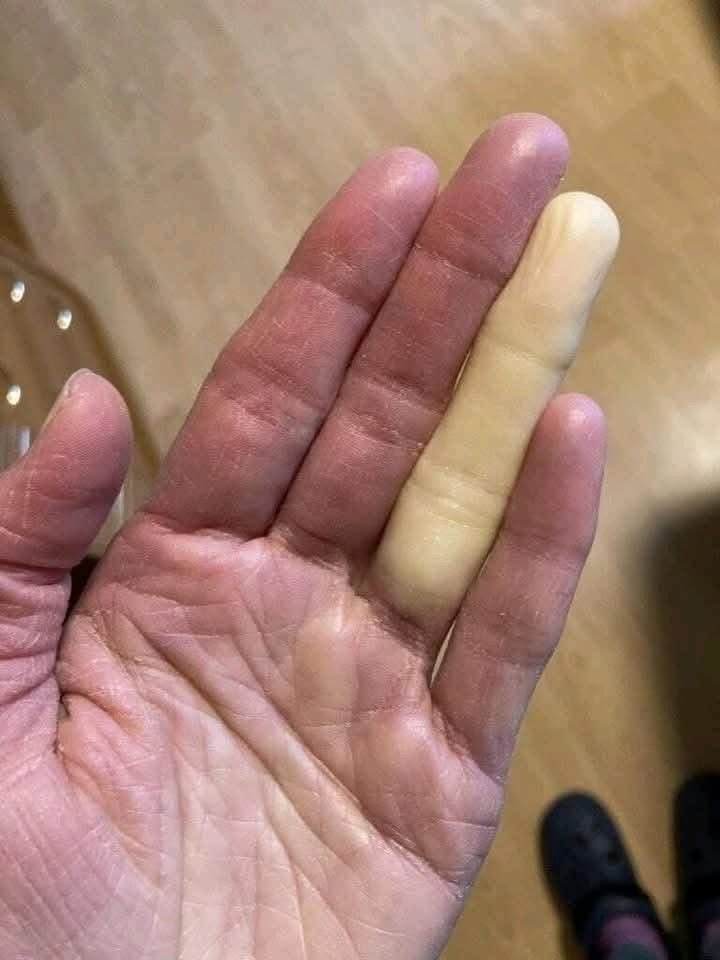 微博侦探们来破案。（不是本人手指） 