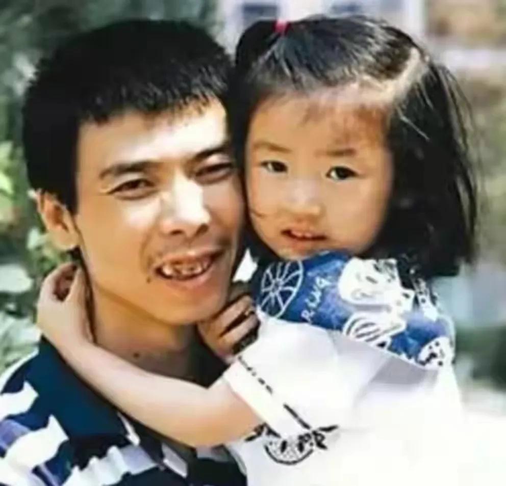 冯小刚的亲生女儿冯思羽，小时候很好看。
他的养女徐朵小时候不好看，龅牙凸嘴，侧面